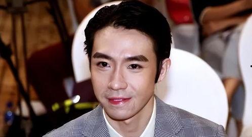 明星谁有白癜风,揭秘患有白癜风的明星